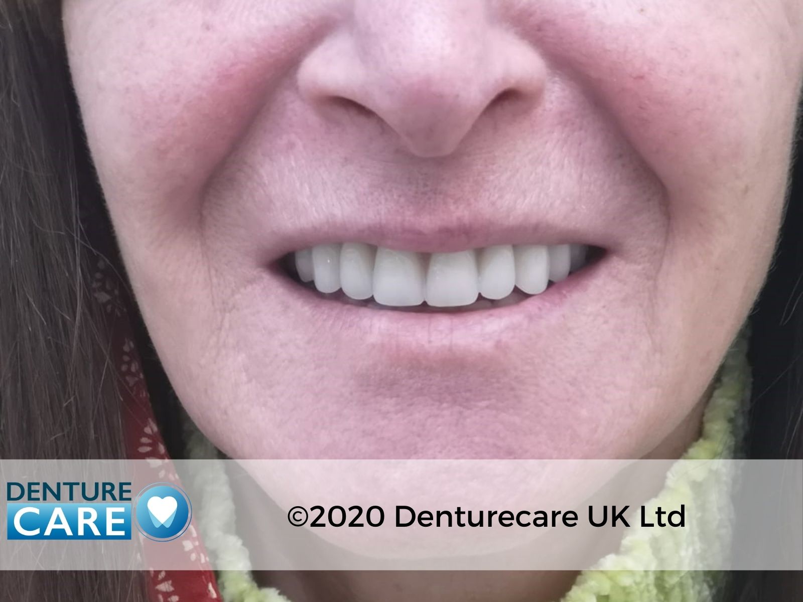Patient’s smile after new full dentures – Doncaster denture clinic