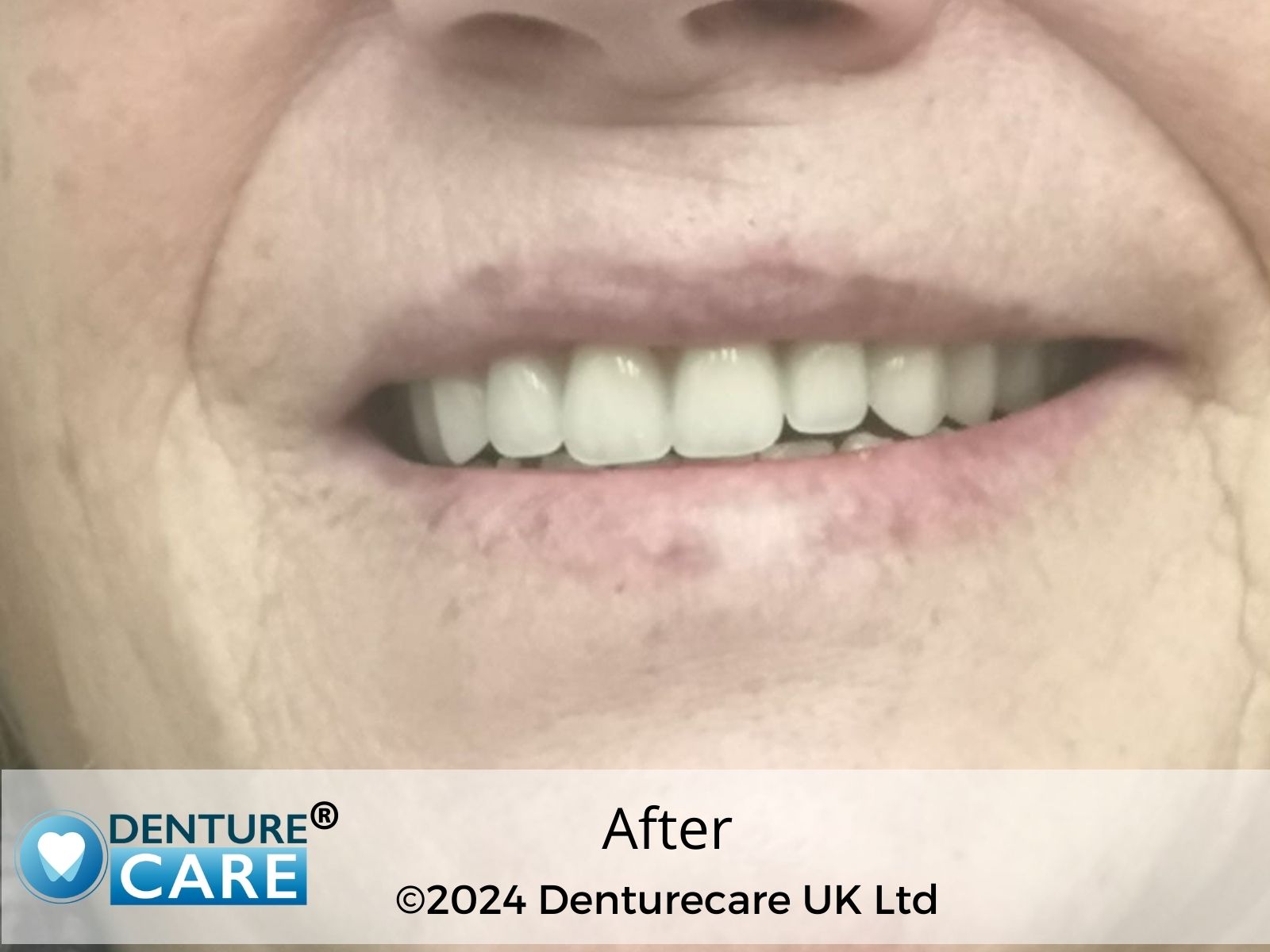 patient's smile Before and after new dentures Barnsley Clinic
