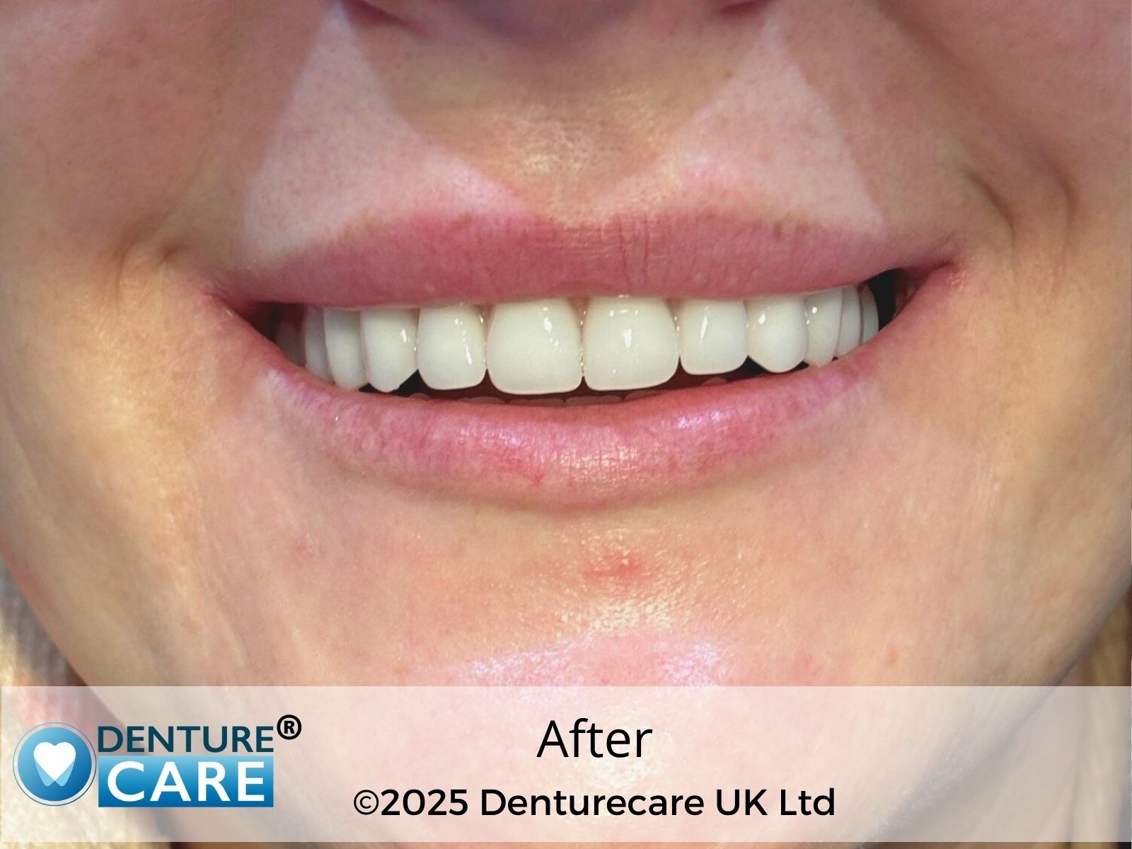 Patient’s smile after new full dentures – Barnsley denture clinic